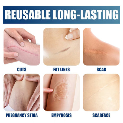A lightweight, easily absorbed formula that helps smooth and fade surgical and C-section scars; specially designed for skin repair and suitable for beauty, personal care, and body care.