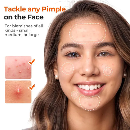 KHAZIX Hydrocolloid Pimple Patch Variety Pack