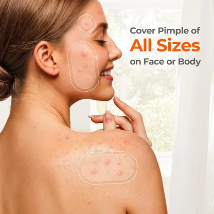 KHAZIX Hydrocolloid Pimple Patch Variety Pack