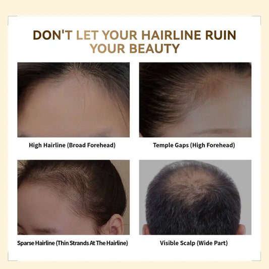 Springorigin Hairline Powder – Root Touch Up, Gray Coverage & Hairline Concealer, 48H Stain-Proof, for Women & Men