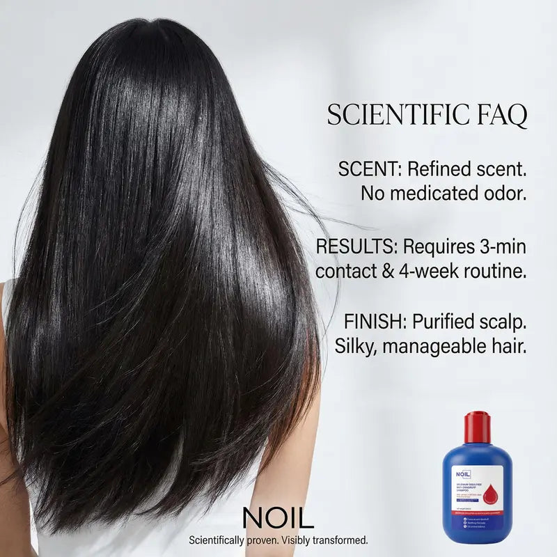 NOIL Selenium Disulfide Shampoo — Anti-Dandruff, Oil Control & Anti-Itch, 300ml